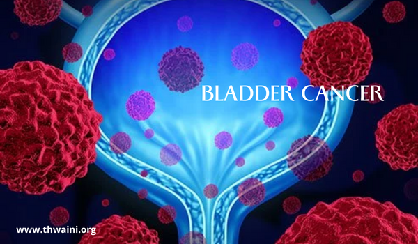 Bladder Cancer Treatment in Dubai