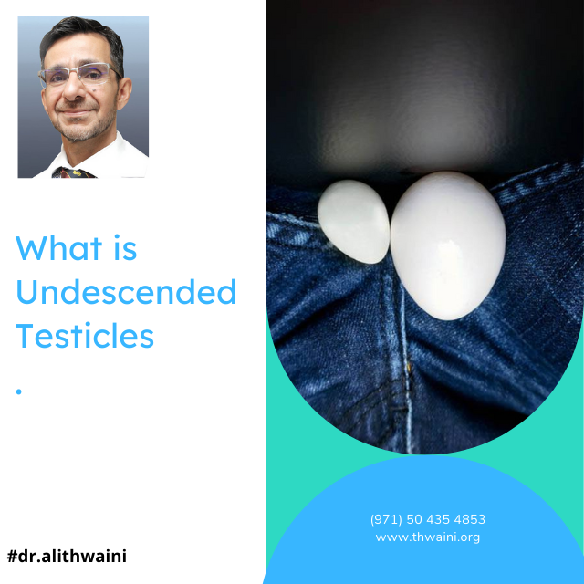Undescended testicles