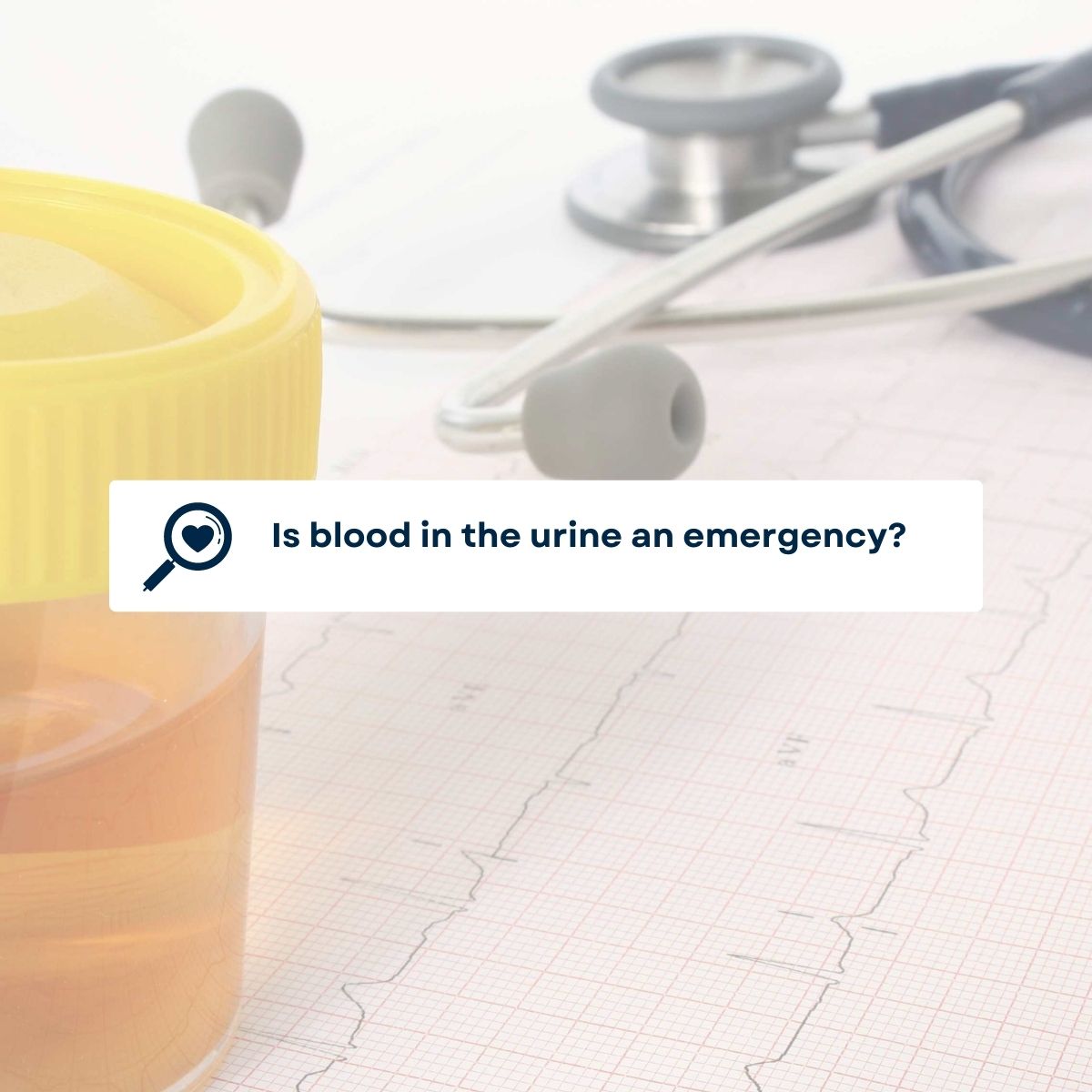 Blood in the urine Have you ever noticed that the color of your urine is darker than normal?